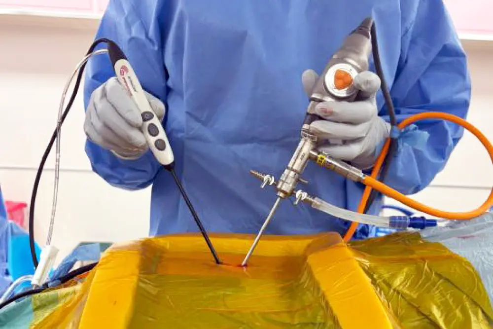 Biportal脊椎内視鏡手術（UBE手術）