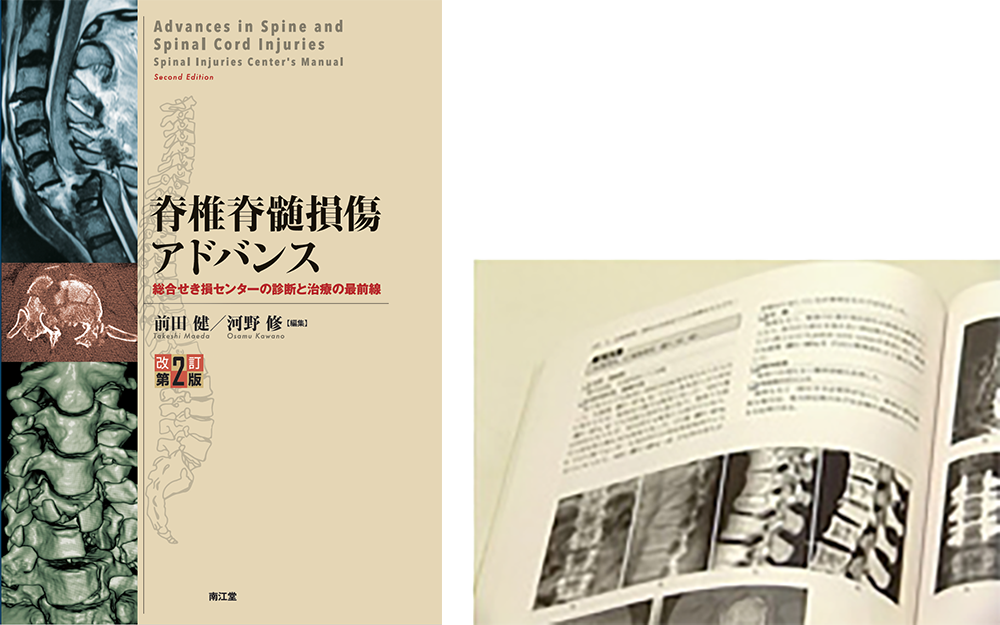 脊椎脊髄損傷アドバンス : 総合せき損センターの診断と治療の最前線 